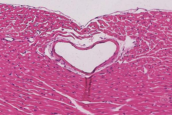 A school started a music program that provides free instrument lessons to students from low-income families