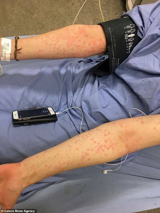 Researchers developed a new vaccine that is effective against multiple strains of a common virus