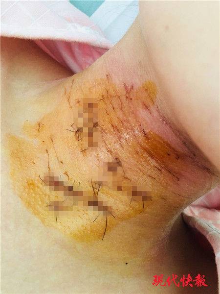 Doctors discovered a new way to diagnose a serious illness at an earlier stage