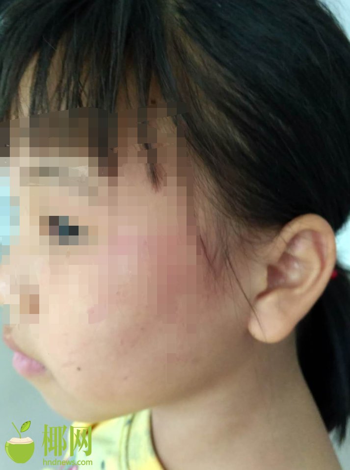 A global organization warned about a shortage of medical supplies in developing countries calling for more donations