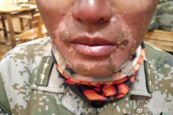 A city council approved a plan to plant 1,000 new trees in urban parks over the next year