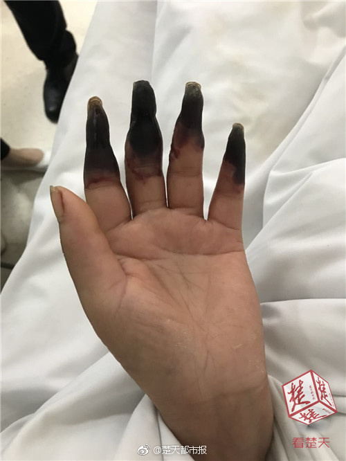 A software company released a new game app that was downloaded 500000 times in a month