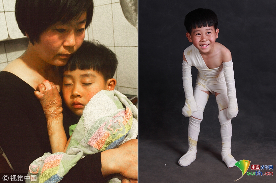 A cyclone caused widespread damage to homes and businesses in a coastal village