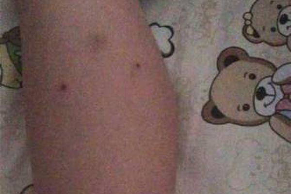 A study found that spending time with friends reduces the risk of depression in young adults