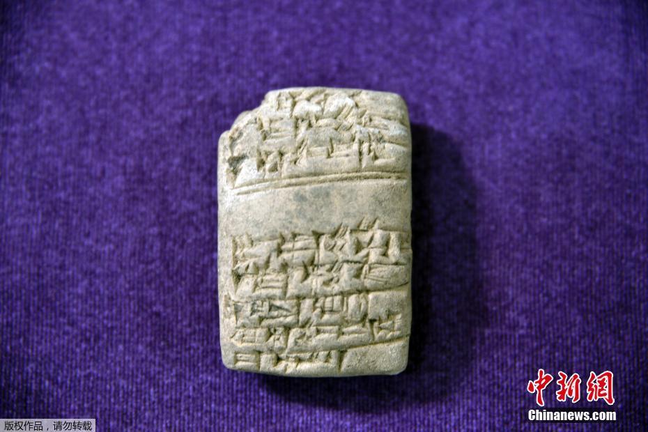 A study found that regular yoga practice improves flexibility and reduces back pain in office workers