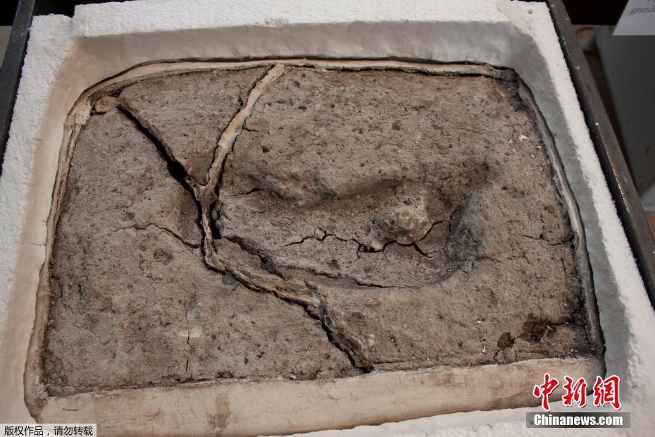 Doctors at a children’s hospital successfully performed a groundbreaking surgery to separate conjoined twins, a procedure that took 12 hours.