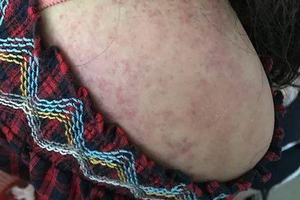 A restaurant added a vegan menu with 10 new plant-based dishes