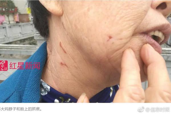 A gym introduced a specialized fitness program for post-pregnancy women