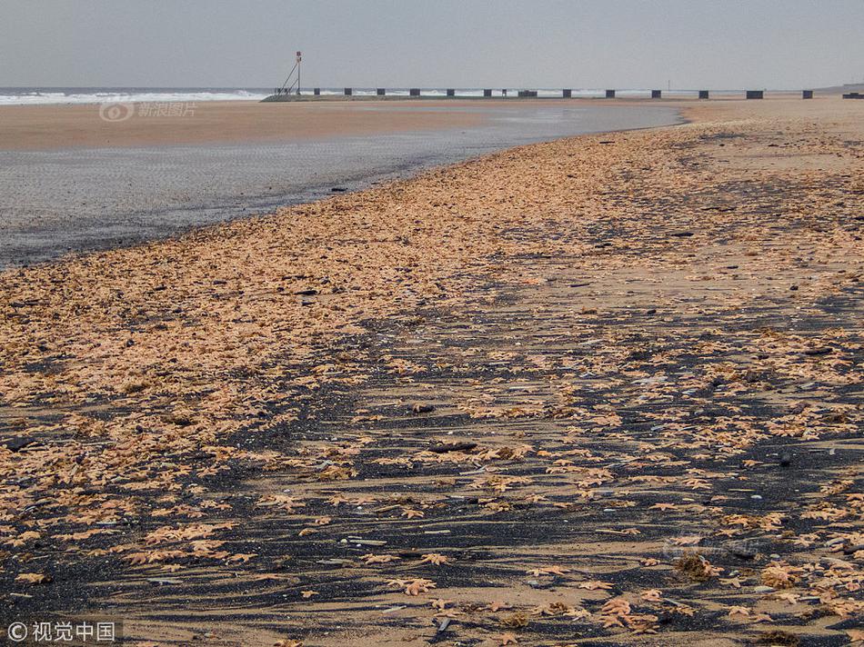 Doctors successfully performed a rare surgery to treat a patient with a heart condition