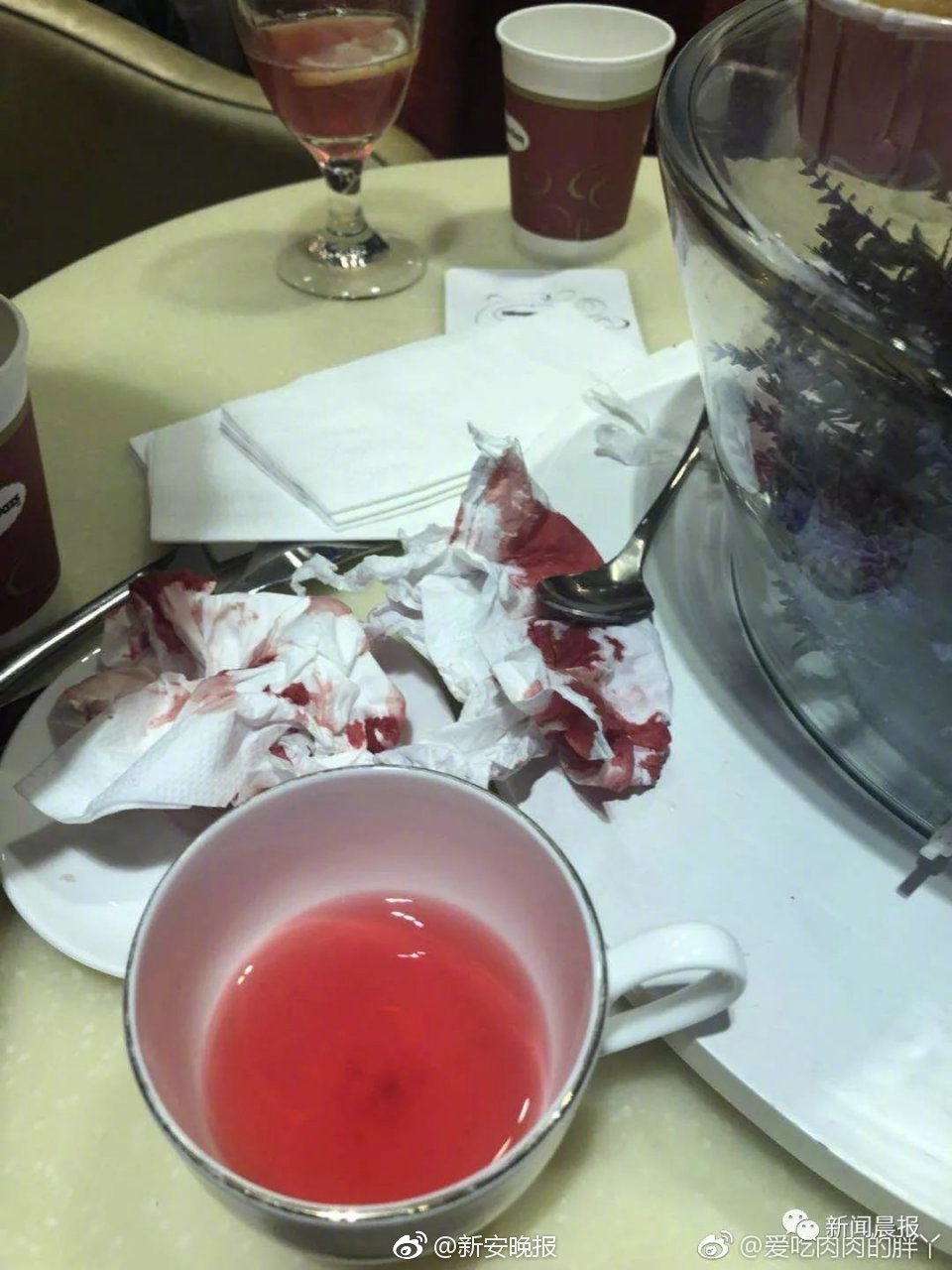 Scientists discovered that poor posture while working at desks contributes to back pain