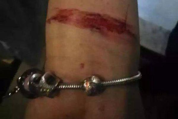 A fashion store started offering alteration services to ensure proper fit