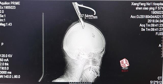 The stock market fluctuated due to uncertainty about government economic policies