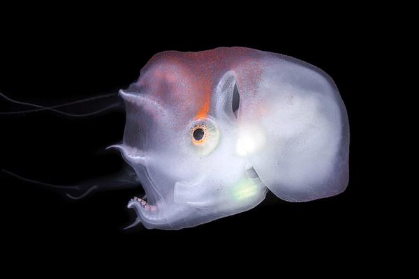 A hospital hired more nurses to improve patient to nurse ratios