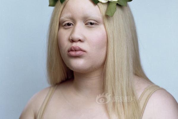 A hospital bought new medical equipment