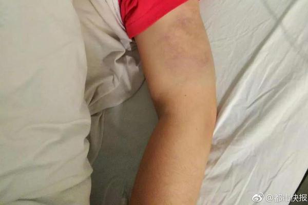 The government passed a law to protect ancient forests from logging and development